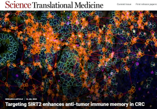 中大六院杨孜欢教授团队结直肠癌的新靶标发现Tissue Cytometry技术揭示 SIRT2 免疫治疗应用潜力