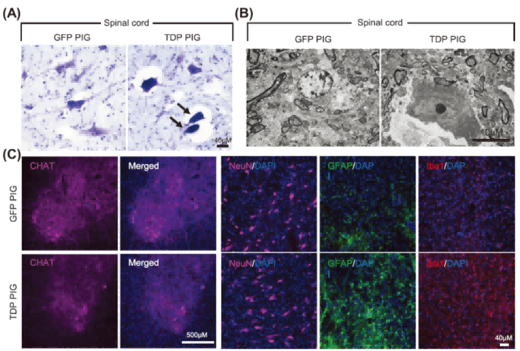 破局渐冻症 | Tissue Cytometry 技术助力 TDP-43 猪模型构建，加速 ALS 新药研发