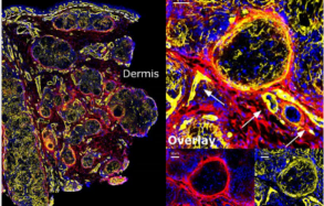 Immunity| Tissue Cytometry原位单细胞精准定量技术结合空间转录组揭示肉芽肿和TLS的形成可能具有相同的生物学过程