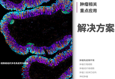 TG肿瘤综合应用解决方案